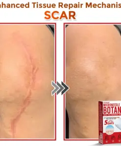 GFOUK® MicroNeedle Botanic Skin Tag Removal Patch