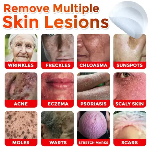 GFOUK® MicroNeedle Botanic Skin Tag Removal Patch