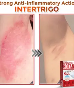 GFOUK® MicroNeedle Botanic Skin Tag Removal Patch