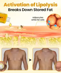 GFOUK™ ThermoFirm Bee Venom Gynecomastia-Oil