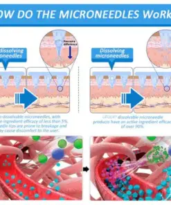 GFOUK®👑Nano Microneedle Patch with SMGT-GLP-1 & Matrixyl 3000