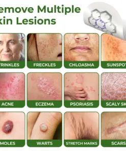 GFOUK® Magnesium MicroNeedle Quick Remove Skin Tag Patches