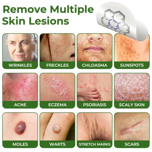 GFOUK® Magnesium MicroNeedle Quick Remove Skin Tag Patches