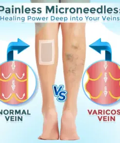 GFOUK® VenaRestore MicroNeedle Vein Repair Patch