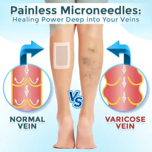 GFOUK® VenaRestore MicroNeedle Vein Repair Patch
