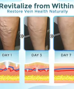 GFOUK® VenaRestore MicroNeedle Vein Repair Patch