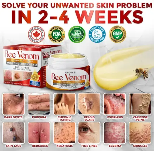 GFOUK® Bee Venom Comprehensive Repair Mcroneedle Cream