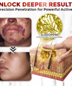 GFOUK® Bee Venom Comprehensive Repair Mcroneedle Cream