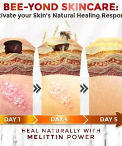 GFOUK® Bee Venom Comprehensive Repair Mcroneedle Cream