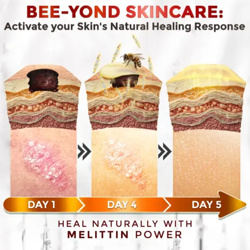 GFOUK® Bee Venom Comprehensive Repair Mcroneedle Cream