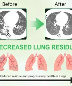 GFOUK® 3X Concentrated Mullein Lung Cleanse Drops