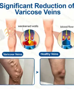 𝐆𝐅𝐎𝐔𝐊® 𝐕𝐞𝐢𝐧𝐓𝐚𝐫𝐠𝐞𝐭 𝐌𝐢𝐜𝐫𝐨𝐧𝐞𝐞𝐝𝐥𝐞 𝐏𝐚𝐭𝐜𝐡