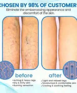 GFOUK® VascuCare Vein Healing Spray