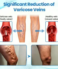 GFOUK® VascuCare Vein Healing Spray