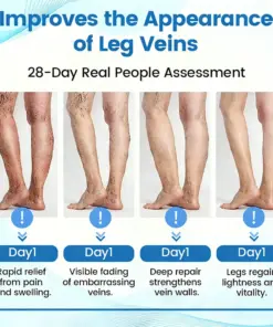 GFOUK® VascuCare Vein Healing Spray