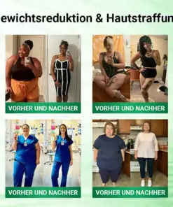 𝐆𝐅𝐎𝐔𝐊® Moringa · Berberin × NAD+ 10-in-1 Advanced Nano Mikronadel-Patch