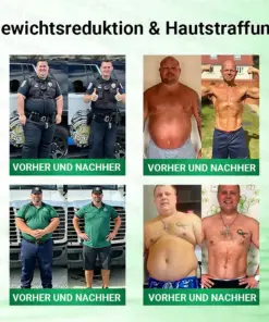 𝐆𝐅𝐎𝐔𝐊® Moringa · Berberin × NAD+ 10-in-1 Advanced Nano Mikronadel-Patch