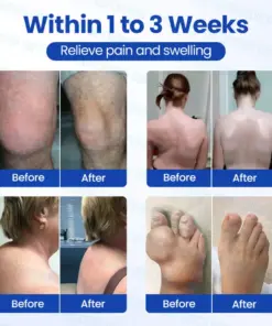 GFOUK® BPC-157 × NSAID 10-in-1 Penetrating Greaseless Arthritis Gel