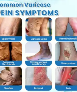 GFOUK® VEINRX Healing Spray