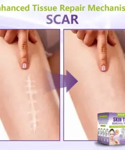 GFOUK® Soluble Microneedle Botanical Skin Tag Removal Patch