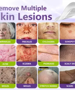 GFOUK® Soluble Microneedle Botanical Skin Tag Removal Patch