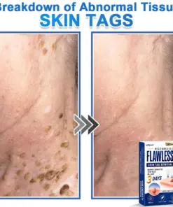 GFOUK® 2026 Newly Upgraded 2-in-1 Microneedle Hydrocolloid Patches