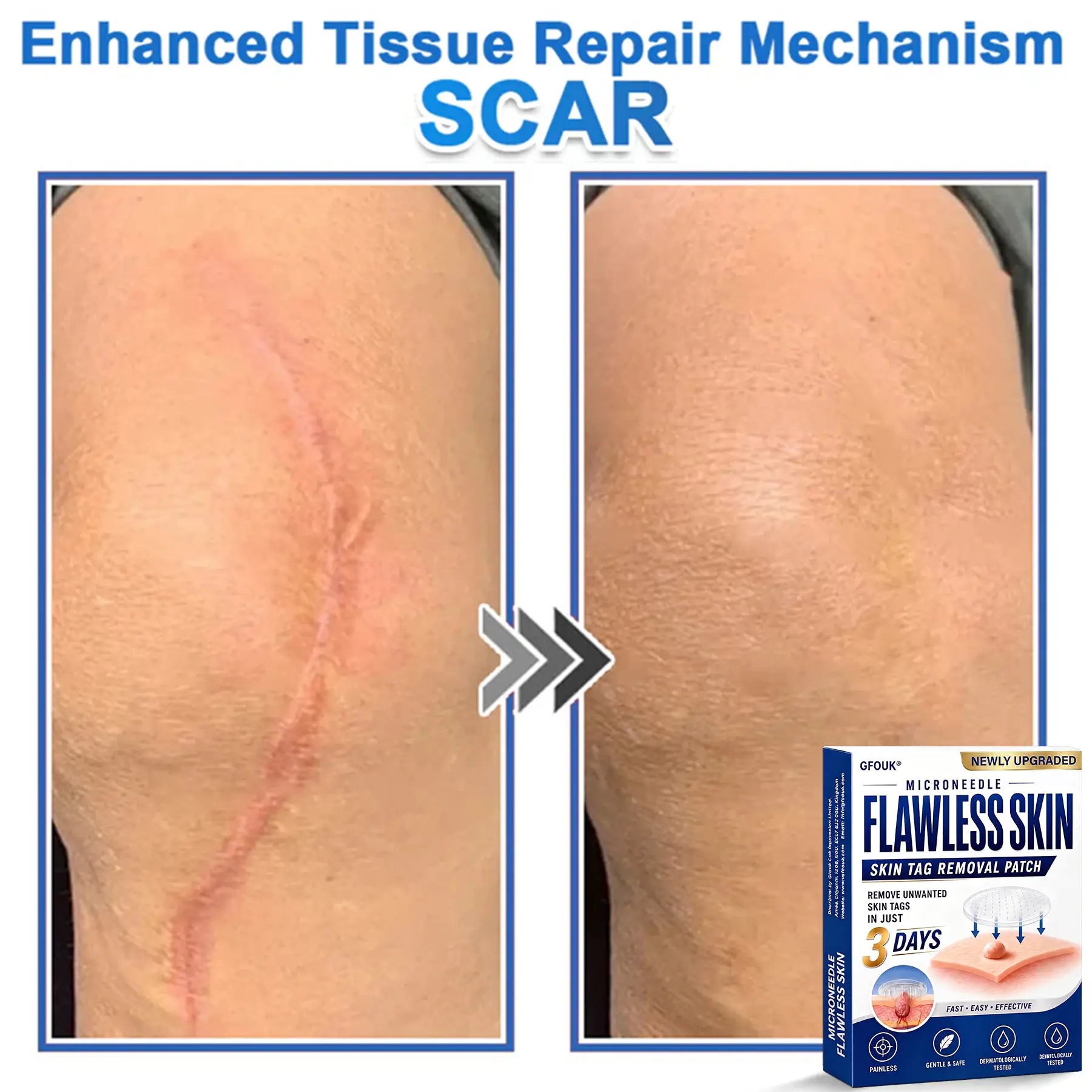 GFOUK® 2026 Newly Upgraded 2-in-1 Microneedle Hydrocolloid Patches