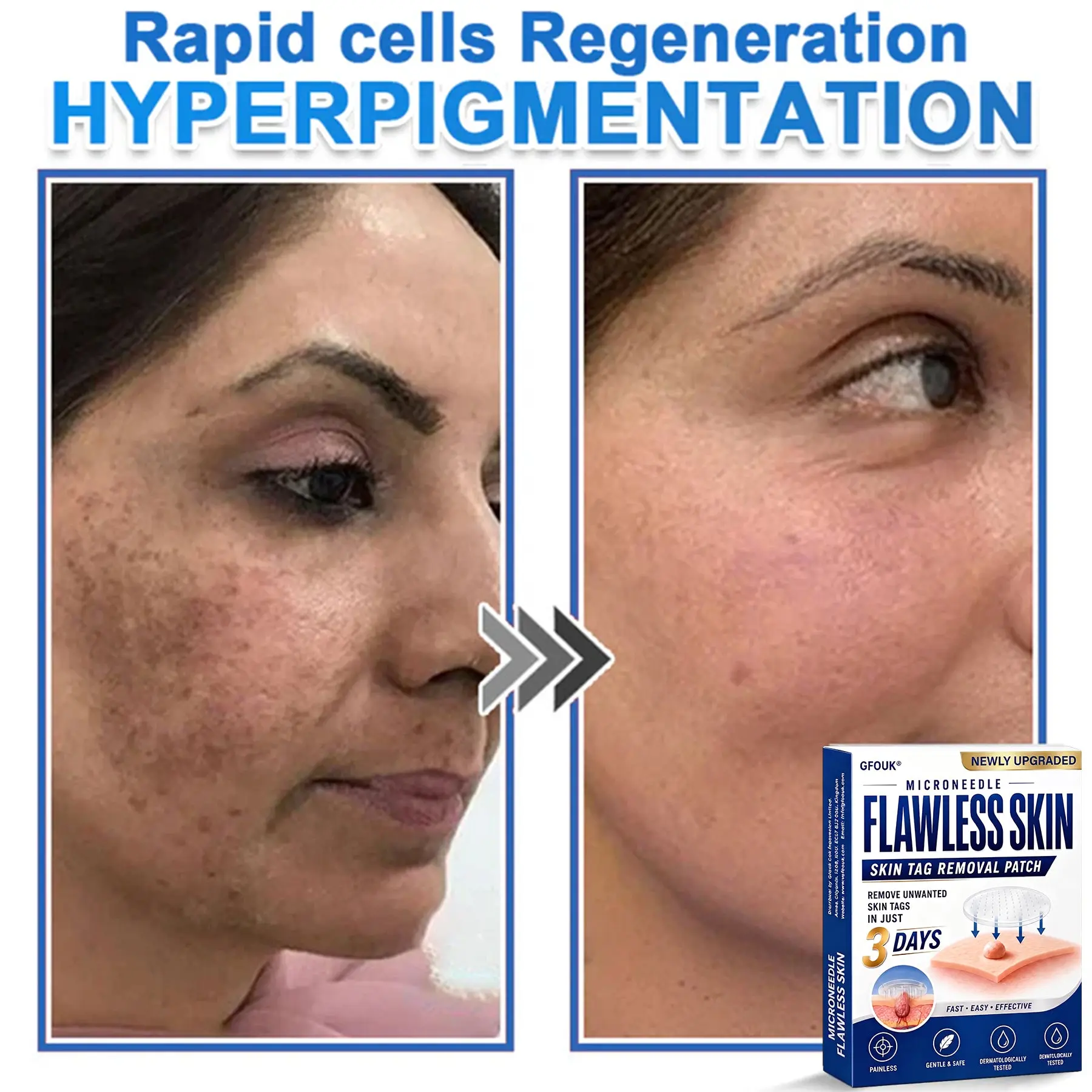 GFOUK® 2026 Newly Upgraded 2-in-1 Microneedle Hydrocolloid Patches