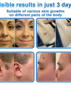 GFOUK® 2026 Newly Upgraded 2-in-1 Microneedle Hydrocolloid Patches
