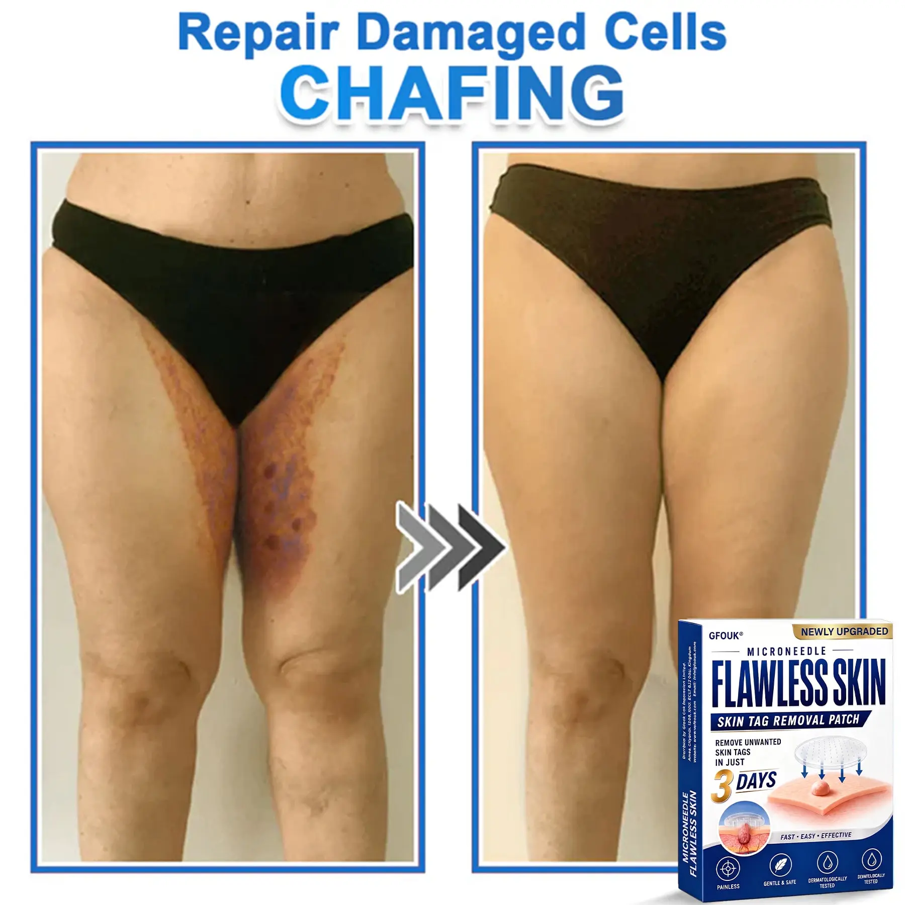 GFOUK® 2026 Newly Upgraded 2-in-1 Microneedle Hydrocolloid Patches