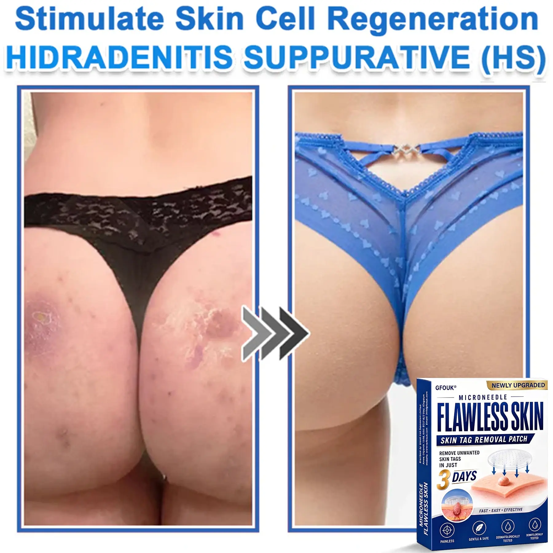 GFOUK® 2026 Newly Upgraded 2-in-1 Microneedle Hydrocolloid Patches