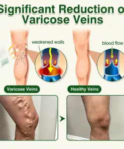 GFOUK® 7-in-1 Microneedle Vein & Lipedema Treatment Patch