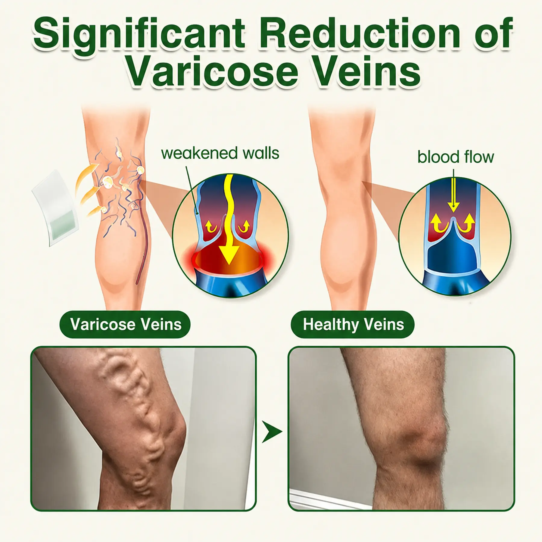 GFOUK® 7-in-1 Microneedle Vein & Lipedema Treatment Patch
