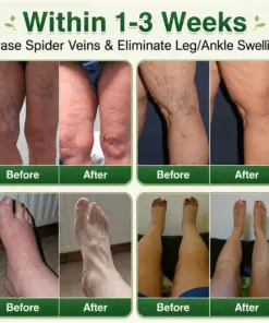GFOUK® 7-in-1 Microneedle Vein & Lipedema Treatment Patch
