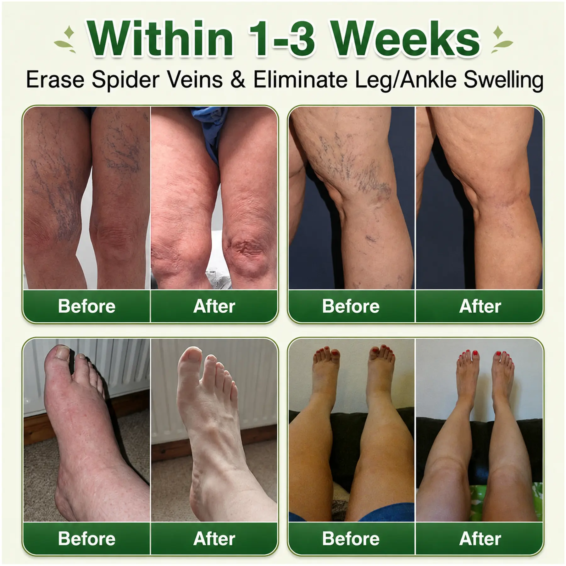 GFOUK® 7-in-1 Microneedle Vein & Lipedema Treatment Patch