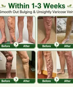 GFOUK® 7-in-1 Microneedle Vein & Lipedema Treatment Patch