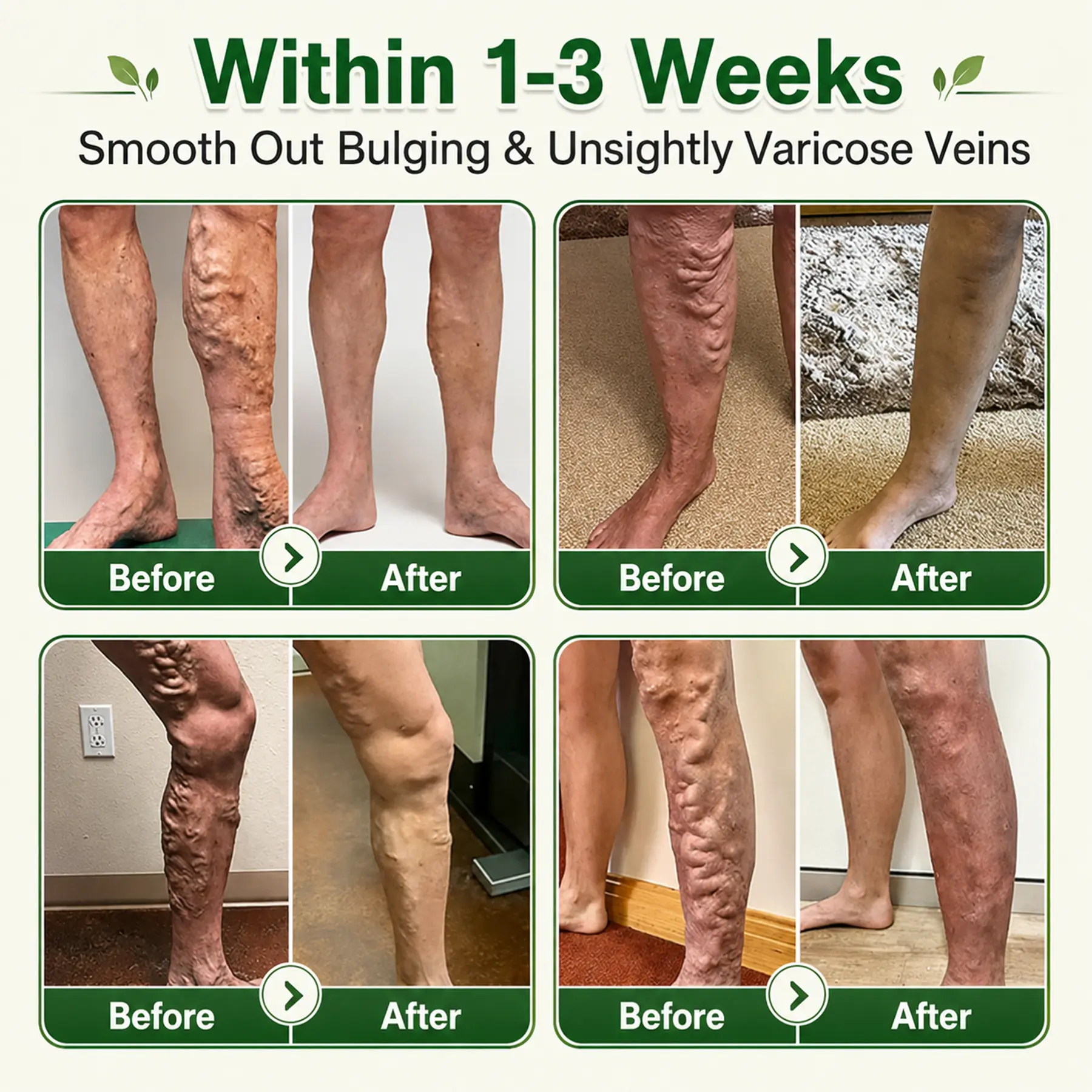 GFOUK® 7-in-1 Microneedle Vein & Lipedema Treatment Patch