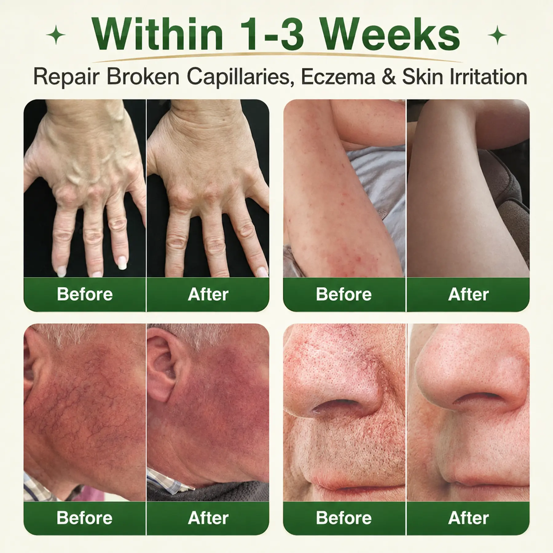 GFOUK® 7-in-1 Microneedle Vein & Lipedema Treatment Patch