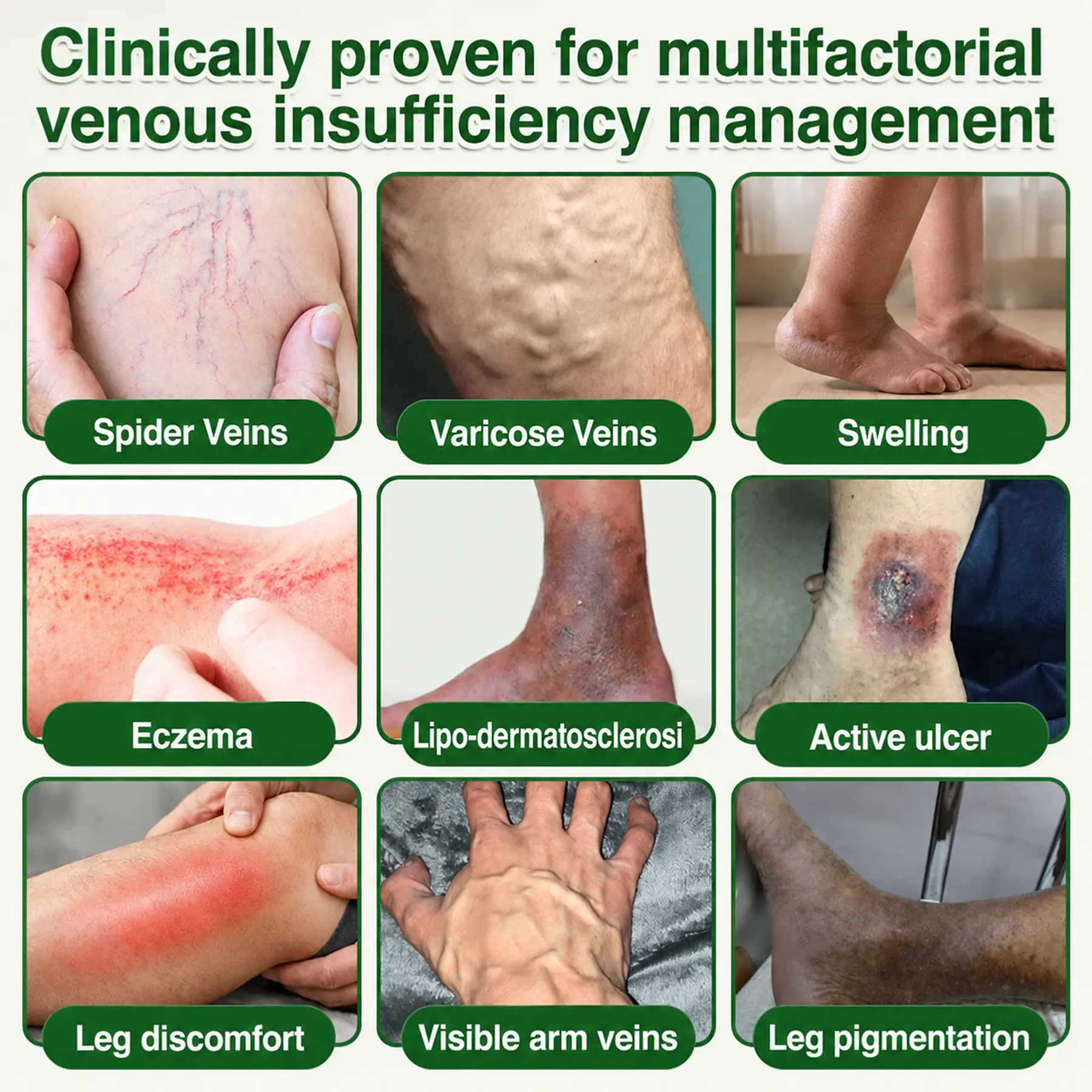 GFOUK® 7-in-1 Microneedle Vein & Lipedema Treatment Patch