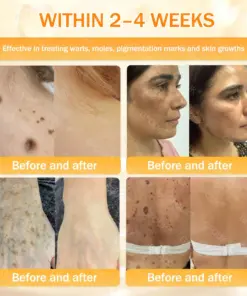 GFOUK® Bee Venom Skin Renewal Cream