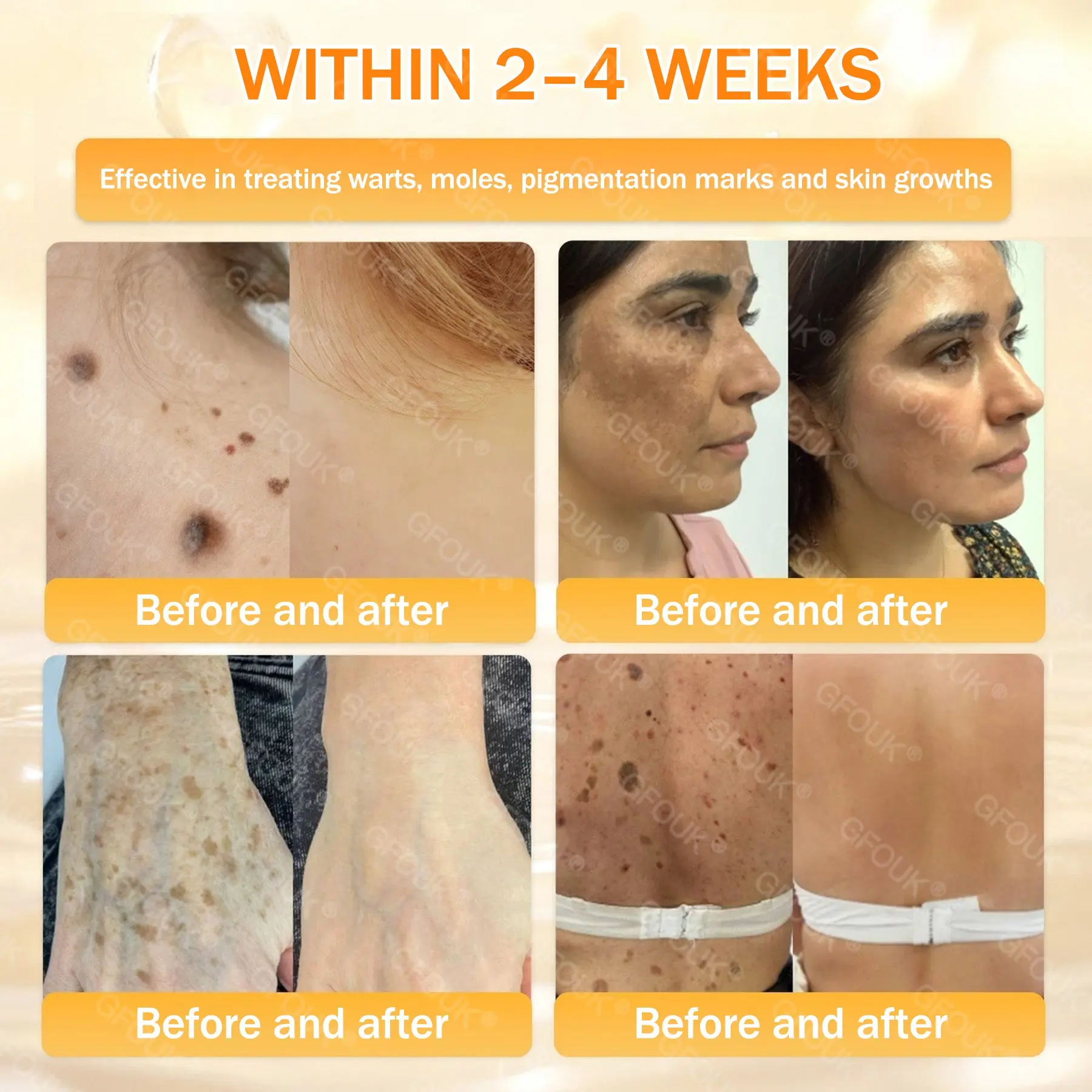 GFOUK® Bee Venom Skin Renewal Cream