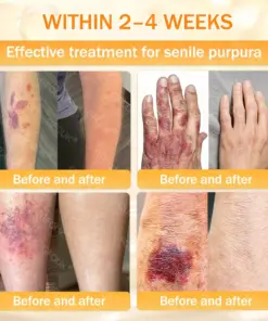 GFOUK® Bee Venom Skin Renewal Cream