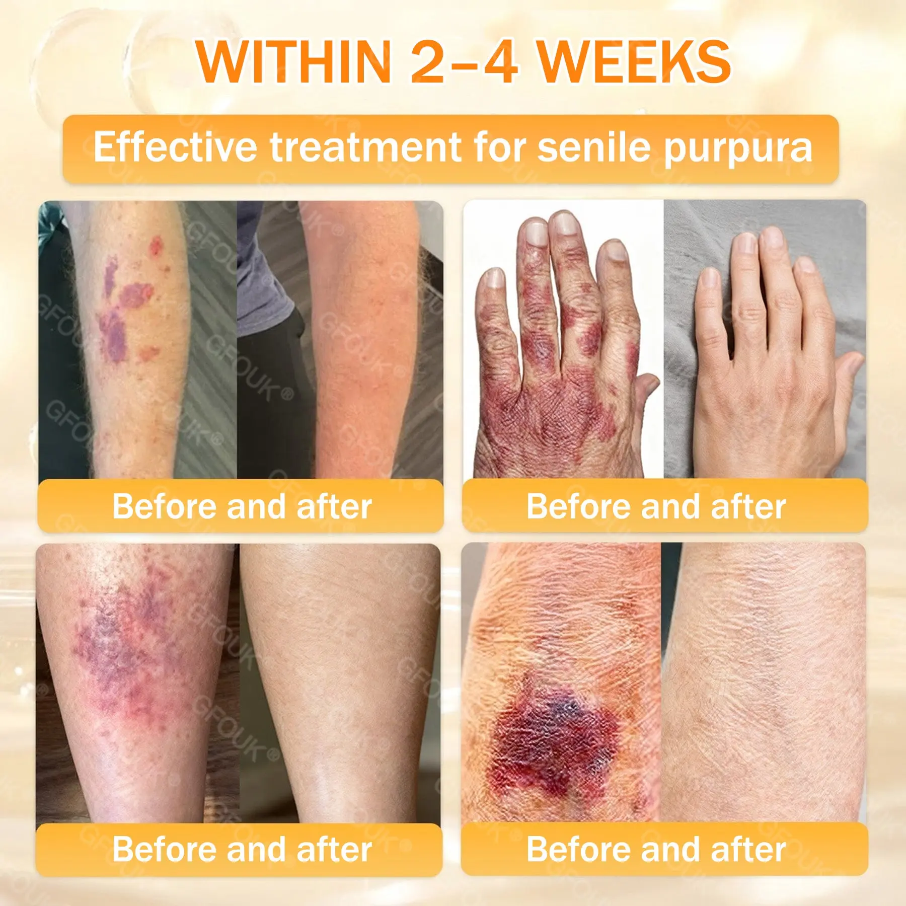 GFOUK® Bee Venom Skin Renewal Cream