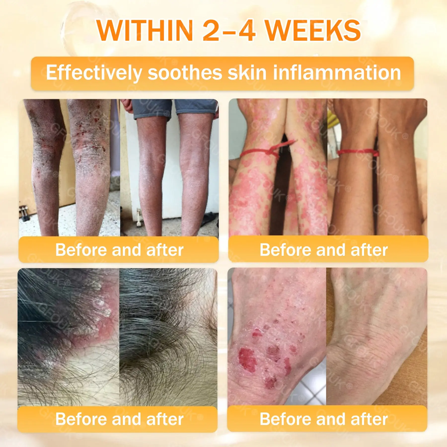 GFOUK® Bee Venom Skin Renewal Cream