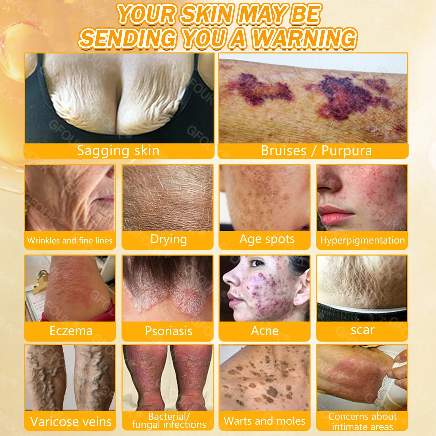 GFOUK® Bee Venom Skin Renewal Cream