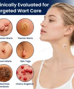 GFOUK® 7-Day MicroNeedle Wart & Skin Tag Removal Patch
