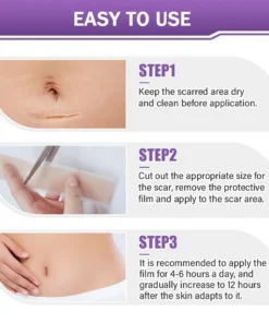 GFOUK® 7-Day Nano Microneedle Scar Repair Tape