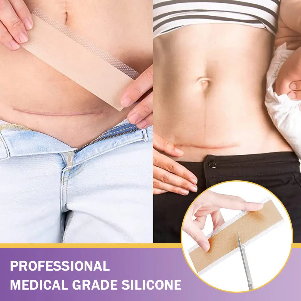 GFOUK® 7-Day Nano Microneedle Scar Repair Tape