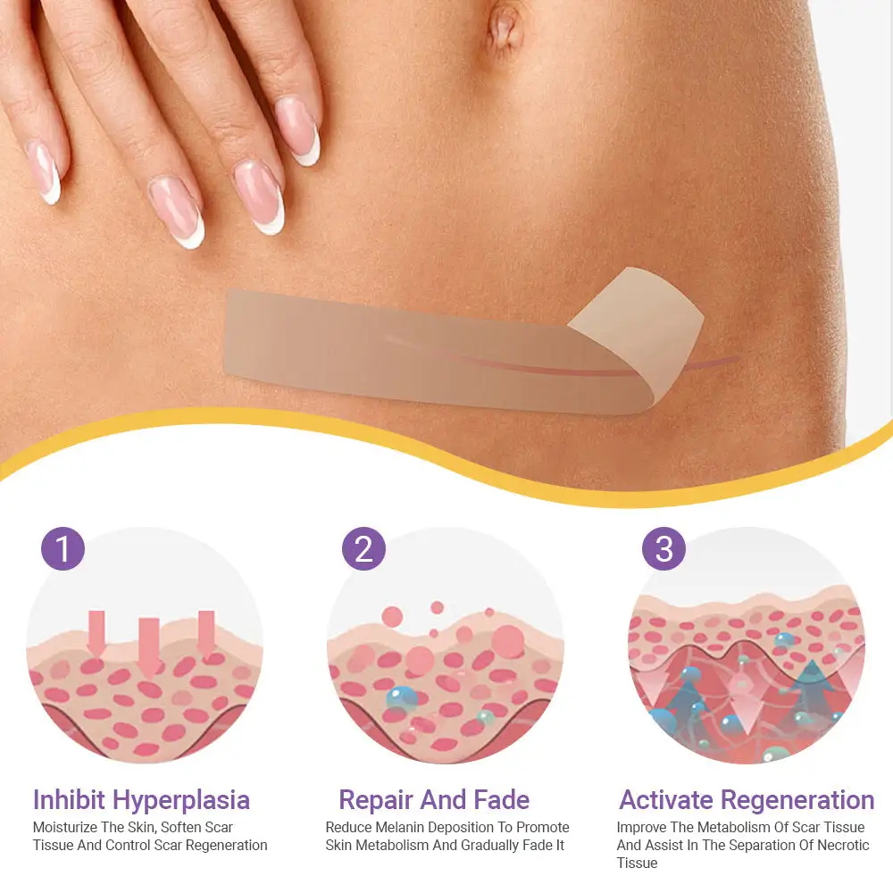 GFOUK® 7-Day Nano Microneedle Scar Repair Tape