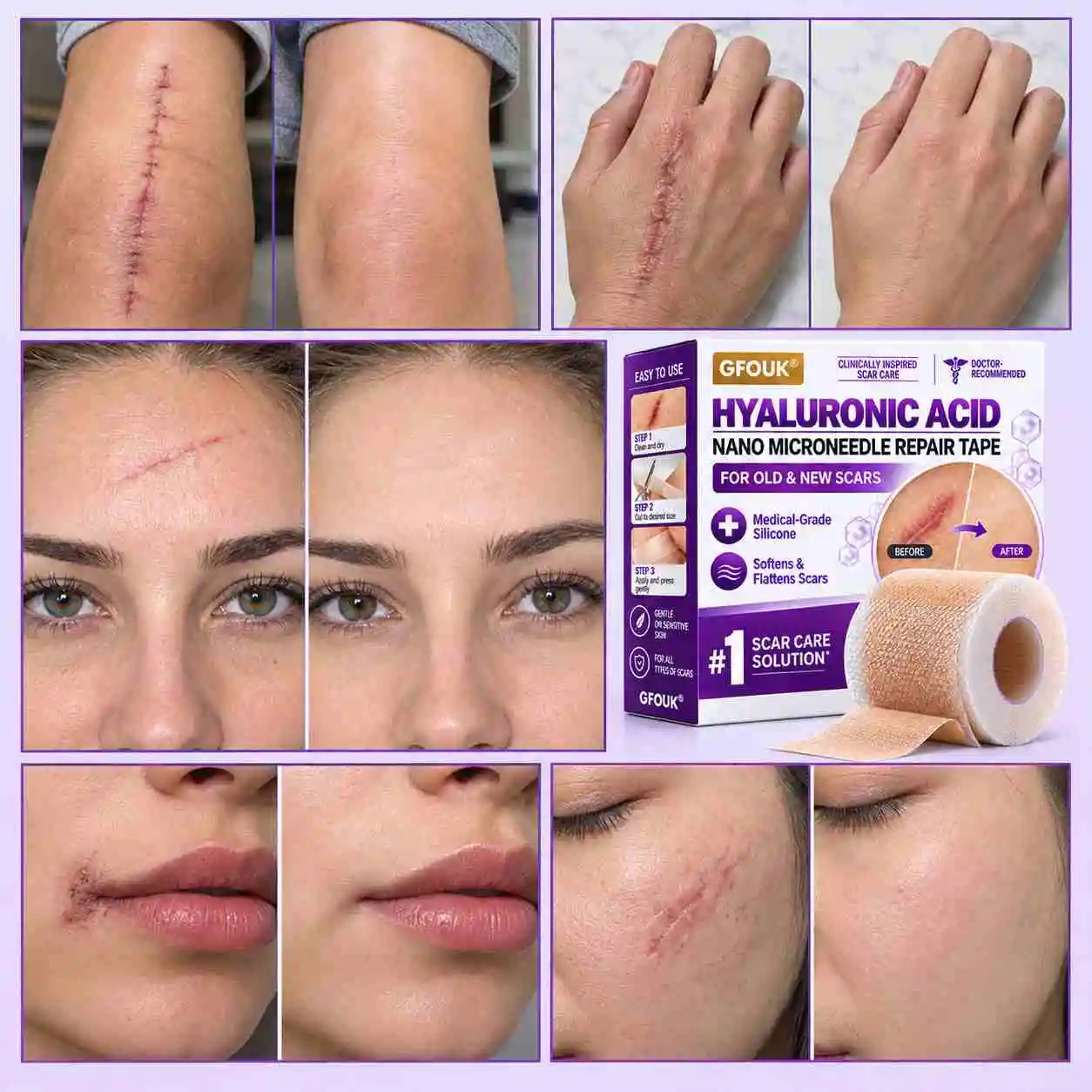 GFOUK® Hyaluronic Acid Nano Microneedle Repair Tape